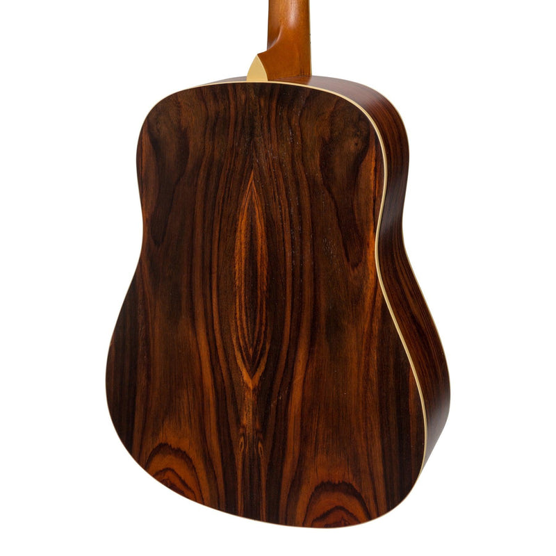 -Sanchez Acoustic Dreadnought Guitar Pack (Rosewood)-Living Music